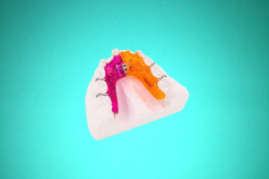 Disjoncteur En Eventail 3