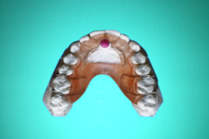 Disjoncteur En Eventail 4