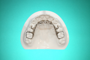 Disjoncteur En Eventail 5