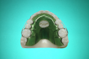 Disjoncteur En Eventail 6