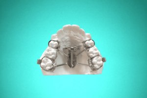 disjoncteur-en-eventail